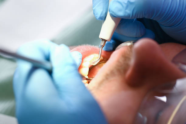 Best Emergency Broken Tooth Repair in Trappe, MD
